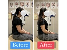 ナオル整体 宮崎院(NAORU整体)/20代女性施術事例【猫背姿勢】