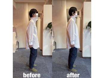 カワル整体 上通り院/その痛み、本当に腰痛?