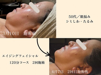 パンセリーノ(Panselinos)の写真
