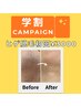 【学割U24】毎日の髭剃りから卒業!清潔感UP☆メンズ髭脱毛 ¥3300→初回¥3000
