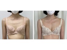 ワイサロン(Y salon)/40代/産後バストアップ/1年