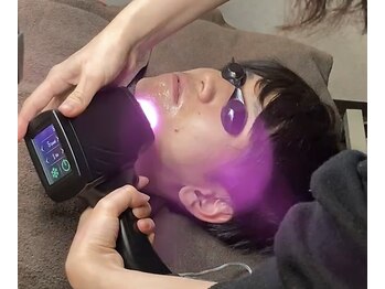 パルファム/IPLひげ脱毛