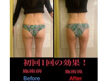 美尻研究所 福岡大名店/初回でここまで変わります！