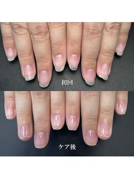 ココ(COCO)/ハンドケア・ネイルケア・爪育成