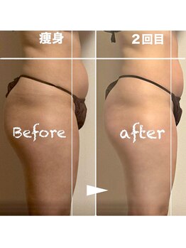 太陽と月/痩身人気No.1★人気急上昇~♪