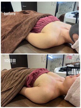 ロココ 豊田店(Rococo)/ビフォーアフター