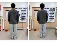 カイロプラクティック輝/姿勢の変化（男性）