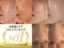 フレキシ 表参道(Flexi)