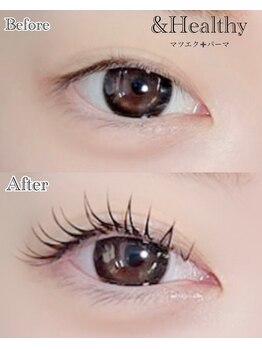 ダゾルビューティー(Dazzle Beauty)/&Healthy