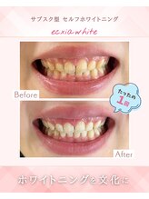 エクシアホワイトニング 浜松店/ホワイトニングビフォーアフター