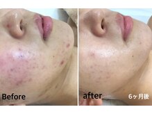 エステティック レイビス 秋田店(RAYVIS)/