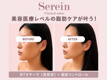スレーン 上本町(Serein)