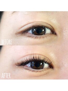 ルプラス(LUPLUS)/◆Before/After◆