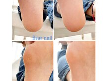 フラワーネイル 古河店(Fleur nail)/フット角質ケア