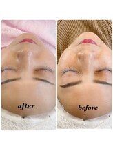 サロン カポネ(Salon Capone)/白玉WAX