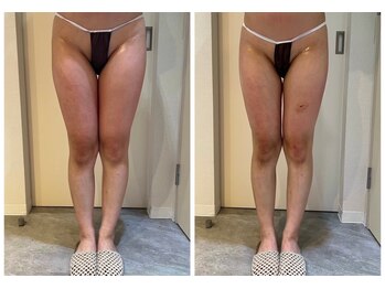 エイシスグロウ(asis glow.)/効果写真