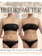 エイエービジュー(Aa.bijou)/