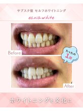 エクシアホワイトニング 浜松店/ホワイトニングビフォーアフター