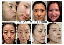 リリーガーデン(Lily Garden)