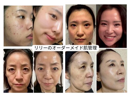 リリーガーデン(Lily Garden)の写真