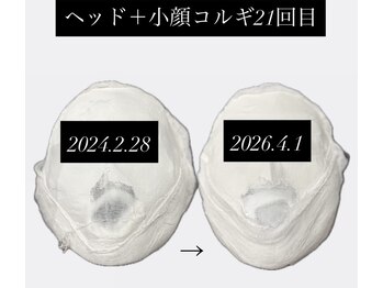 クレシア(CRECIA)/約2年間での変化
