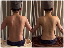 ケムズ インプルーブメントサロン(KMS IMPROVEMENT salon)の雰囲気（ガチガチ首肩集中ケア１回でここまでスッキリしました！）