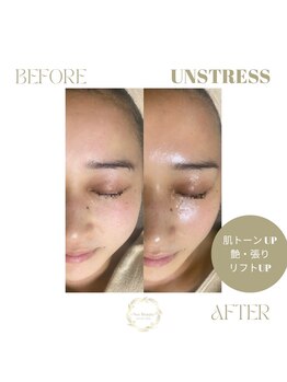 ネス 沖縄店(Nes.)/UNSTRESS/アンスレス