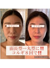 ウルワシ(Uruwashi)/★ビフォーアフター★