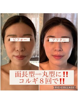 ウルワシ(Uruwashi)/★ビフォーアフター★