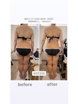 トランキーロ(Tranquilo)/痩身120分週1回ペース　5回目
