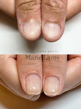 マリーロール 淀屋橋本店(Marie Laure)/自爪育成/深爪矯正/ネイルケア