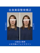 クローバー(Clover)/お客様のbefore/after