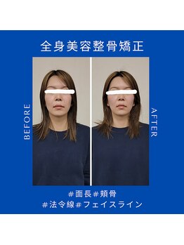 クローバー(Clover)/お客様のbefore/after