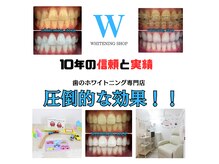 ホワイトニングショップ 金沢店(WHITENING SHOP)