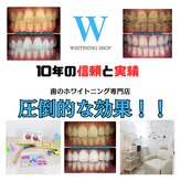ホワイトニングショップ 金沢店(WHITENING SHOP)
