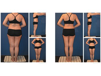 ミネルバエンダモロジー/エンダモロジー/痩身/ウェルネス