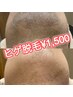 【メンズ】ヒゲ脱毛/青髭・剃刀マケに◎光脱毛！スキンケアで眠くなる★1500