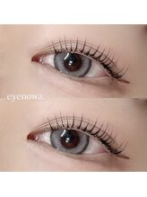 アイノワ 伏石駅前(eyenowa.)/ケア重視のこだわり技！