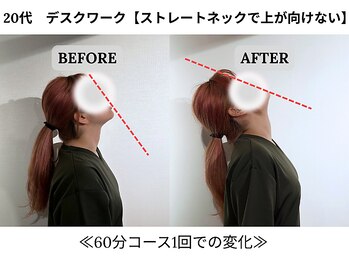 240鍼灸マッサージ院 麻布十番/1回の施術　ビフォーアフター