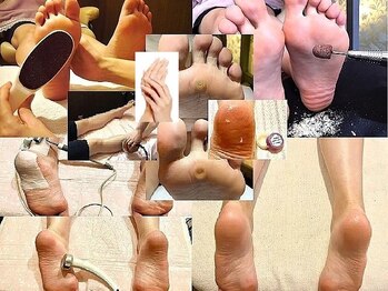 ビサンテ サロンの写真/角質ケア&特許,角質育成ケアで魚の目/タコ/ガサガサ足裏,カカト,ツルプル!3D足バランス調整,足裏~全身整う!