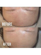 ビーマジック(Be Magic)/脱毛/フェイシャル/痩身/眉毛/眉