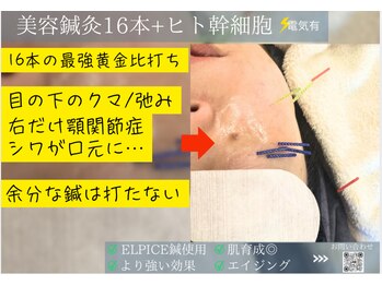 ミエリア美容鍼灸院(mielia美容鍼灸院)/幹細胞美容鍼灸〈幹細胞facia〉