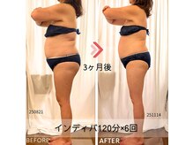 ヒーリングサプリ(Healing Supple)の雰囲気（インディバ筋膜リンパマッサージは細胞活性！痩せやすい体質へ）