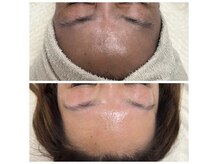 コンディションスキン(condition skin)の雰囲気(天然マツヤニWAXで1トーン明るい肌に!)