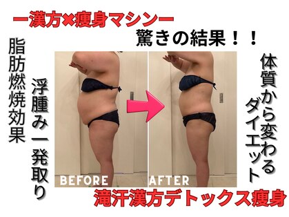 ソエルテ(soerute)の写真