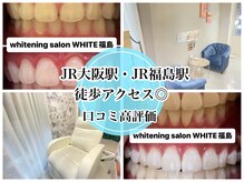 ホワイトニングサロン ホワイト(WHITE)