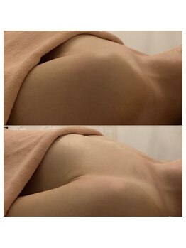 ベルフェム(Bellefemme)/ふっくらプルプルバストへ♪