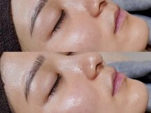 アオ 渋谷(ao.)/ララピール