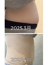 グランツ トリムリターン神奈川横浜店(glanz)/ジョイントエステ×美容整体