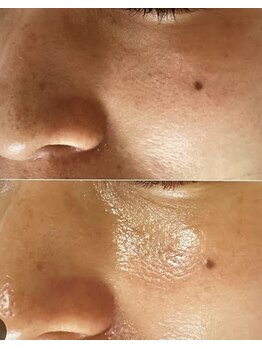 サナティオ(SANATIO)/メンズフェイシャル